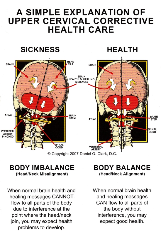 Morgantown Chiropractic Care After a Motor Vehicle Collision
