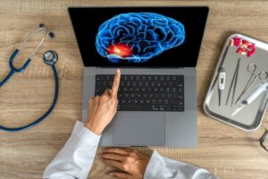 Top view of doctor showing a x-ray of pain in the brain on a laptop. Migraine Headache concept