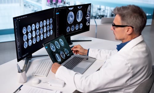 physician in lab coat reviewing brain MRI scans on multiple screens